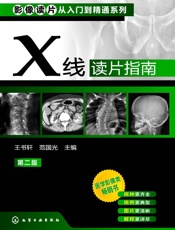 X线读片指南
