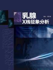 乳腺X线征象分析