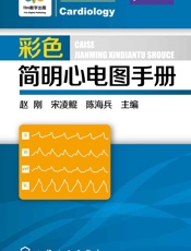 彩色简明心电图手册