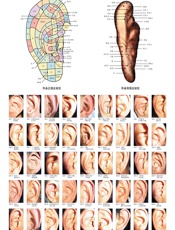 望耳诊病挂图 - 周幸来