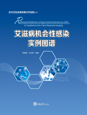 艾滋病机会性感染实例图谱