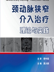 颈动脉狭窄介入治疗——理论与实践 - 莫大鹏
