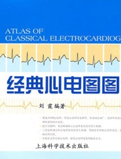 经典心电图图谱