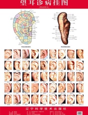 望耳诊病挂图
