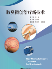 腋臭微创治疗新技术