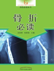 骨折必读