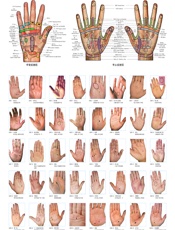 望手诊病挂图 - 赵理明