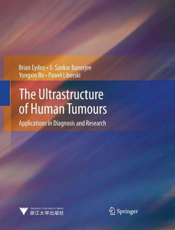 人体肿瘤超微结构在其诊断及研究中的应用