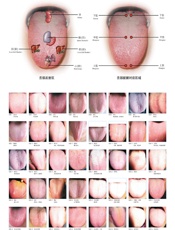 望舌诊病挂图 - 周幸来