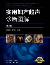 实用妇产超声诊断图解