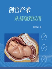 剖宫产术从基础到应用 - 颜建英