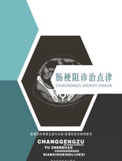 肠梗阻诊治点津 - 李中信，贾漪涛